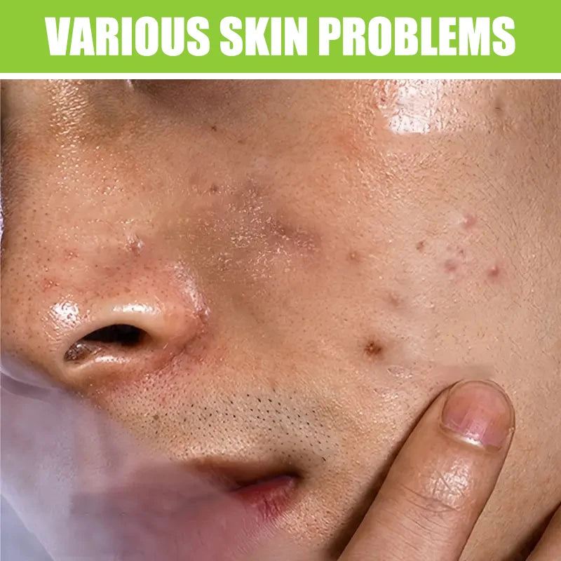 Oil Control Men Facial Cleanser With Salicylic Acid Green Tea Remove Blackheads Deep Purify Skin Shrink Pores Face Wash